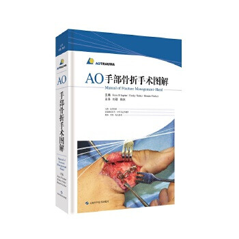 AO手部骨折手術圖解 AO手部骨折手術圖解