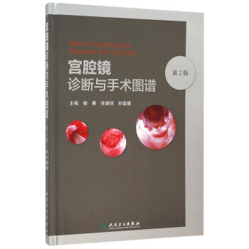 宮腔鏡診斷與手術圖譜 宮腔鏡診斷與手術圖譜